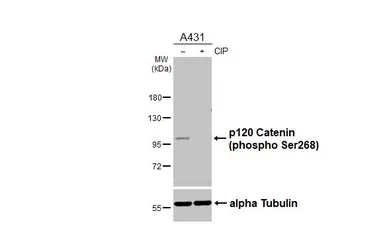 Anti-p120 Catenin (phospho Ser268) antibody [HL6869] used in Western Blot (WB). GTX649713