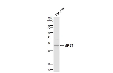 Anti-MPST antibody [HL6870] used in Western Blot (WB). GTX649714