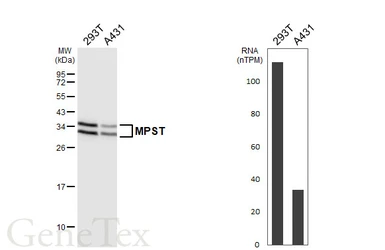 Anti-MPST antibody [HL6870] used in Western Blot (WB). GTX649714