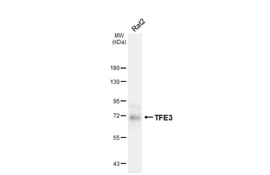 Anti-TFE3 antibody [HL6873] used in Western Blot (WB). GTX649717