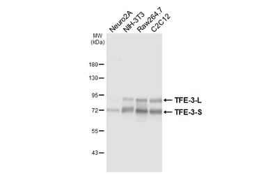Anti-TFE3 antibody [HL6873] used in Western Blot (WB). GTX649717