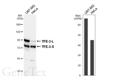 Anti-TFE3 antibody [HL6873] used in Western Blot (WB). GTX649717