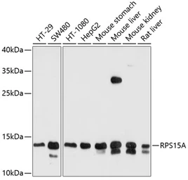 Anti-RPS15A antibody used in Western Blot (WB). GTX64972