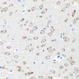 Anti-RPS15A antibody used in IHC (Paraffin sections) (IHC-P). GTX64972
