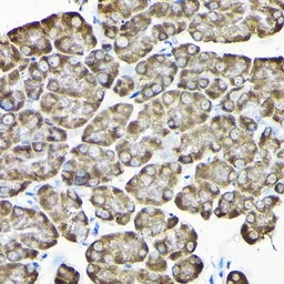Anti-RPS15A antibody used in IHC (Paraffin sections) (IHC-P). GTX64972