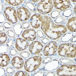 Anti-RPS15A antibody used in IHC (Paraffin sections) (IHC-P). GTX64972