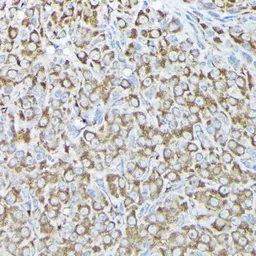 Anti-RPS15A antibody used in IHC (Paraffin sections) (IHC-P). GTX64972