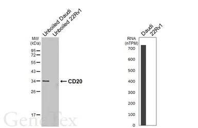 Anti-CD20 antibody [GT450] used in Western Blot (WB). GTX649726