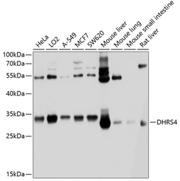 Anti-DHRS4 antibody used in Western Blot (WB). GTX64973