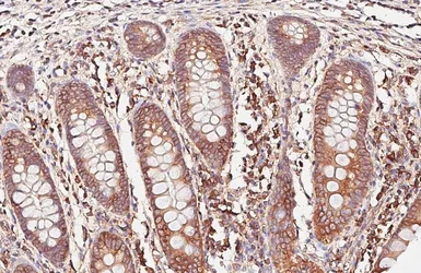 Anti-PDI antibody [HL6879] used in IHC (Paraffin sections) (IHC-P). GTX649731