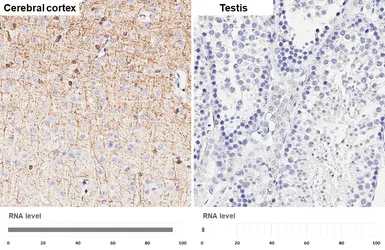 Anti-CNPase antibody [HL6881] used in IHC (Paraffin sections) (IHC-P). GTX649733