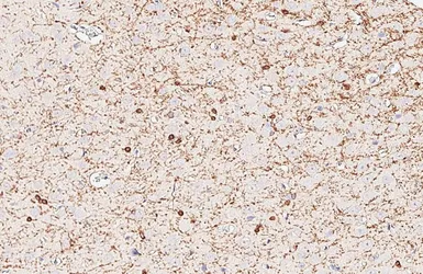 Anti-CNPase antibody [HL6881] used in IHC (Paraffin sections) (IHC-P). GTX649733