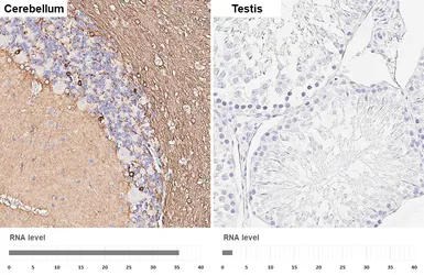 Anti-CNPase antibody [HL6881] used in IHC (Paraffin sections) (IHC-P). GTX649733