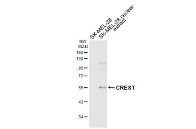 Anti-CREST antibody [HL6890] used in Western Blot (WB). GTX649742