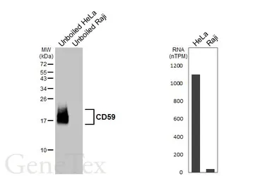 Anti-CD59 antibody [HL6893] used in Western Blot (WB). GTX649745