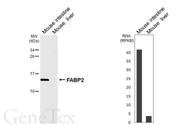 Anti-FABP2 antibody [HL6897] used in Western Blot (WB). GTX649749