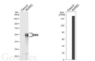 Anti-ERG antibody [HL6903] used in Western Blot (WB). GTX649755