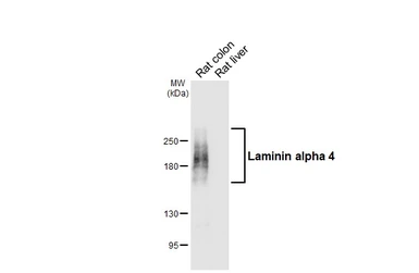 Anti-Laminin alpha 4 antibody [HL6906] used in Western Blot (WB). GTX649758