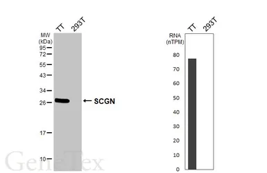 Anti-SCGN antibody [HL6921] used in Western Blot (WB). GTX649778