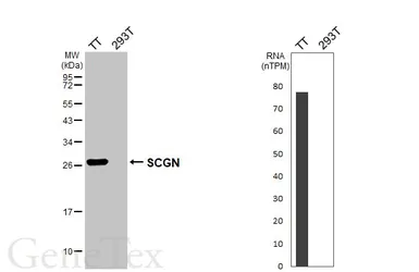 Anti-SCGN antibody [HL6925] used in Western Blot (WB). GTX649782