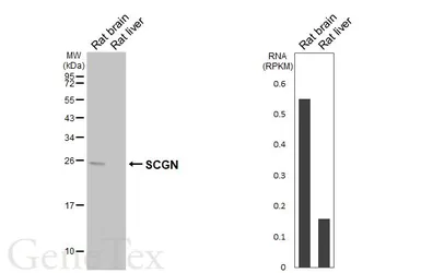 Anti-SCGN antibody [HL6925] used in Western Blot (WB). GTX649782
