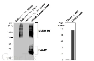 Anti-EAAT2 antibody [HL6927] used in Western Blot (WB). GTX649784