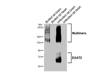 Anti-EAAT2 antibody [HL6927] used in Western Blot (WB). GTX649784