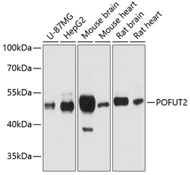 Anti-POFUT2 antibody used in Western Blot (WB). GTX64979