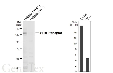 Anti-VLDL Receptor antibody [HL6941] used in Western Blot (WB). GTX649798