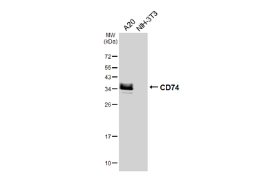 Anti-CD74 antibody [HL6948] used in Western Blot (WB). GTX649805