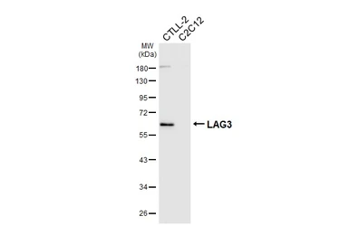 Anti-LAG3 antibody [HL6949] used in Western Blot (WB). GTX649806