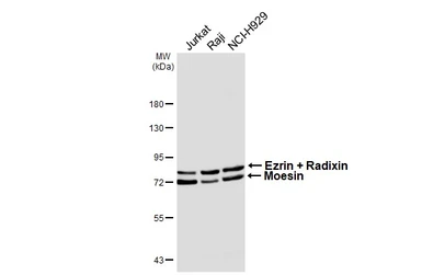 Anti-Ezrin + Radixin + Moesin antibody [HL6955] used in Western Blot (WB). GTX649812
