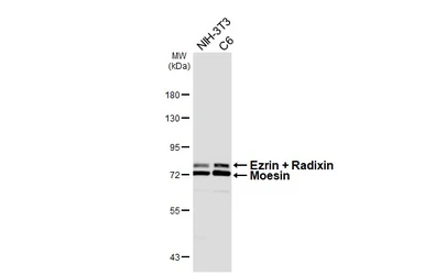 Anti-Ezrin + Radixin + Moesin antibody [HL6955] used in Western Blot (WB). GTX649812