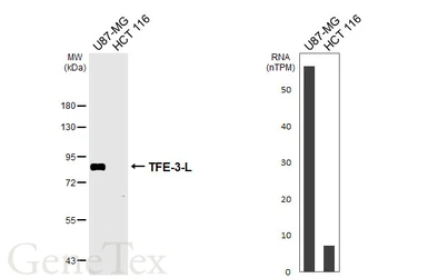 Anti-TFE3 antibody [HL6956] used in Western Blot (WB). GTX649813