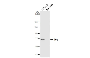 Anti-Tec antibody [HL6960] used in Western Blot (WB). GTX649817
