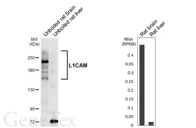 Anti-L1CAM antibody [GT455] used in Western Blot (WB). GTX649820