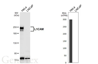 Anti-L1CAM antibody [GT455] used in Western Blot (WB). GTX649820