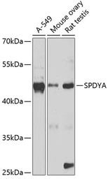 Anti-SPDYA antibody used in Western Blot (WB). GTX64983