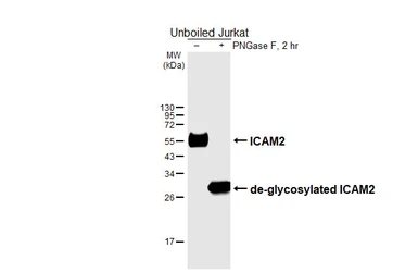 Anti-ICAM2 antibody [HL6972] used in Western Blot (WB). GTX649834