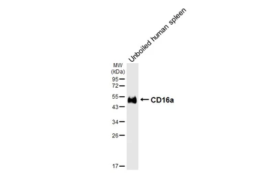 Anti-CD16a antibody [HL6978] used in Western Blot (WB). GTX649840