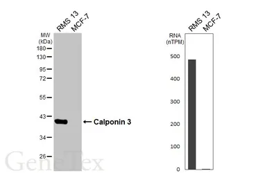 Anti-Calponin 3 antibody [HL6984] used in Western Blot (WB). GTX649846