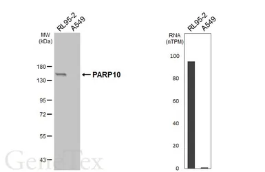 Anti-PARP10 antibody [HL6986] used in Western Blot (WB). GTX649848