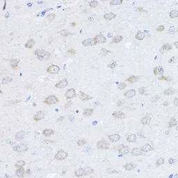 Anti-UBE4A antibody used in IHC (Paraffin sections) (IHC-P). GTX64985