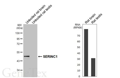 Anti-SERINC1 antibody [HL6988] used in Western Blot (WB). GTX649850