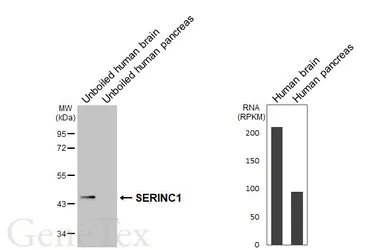 Anti-SERINC1 antibody [HL6988] used in Western Blot (WB). GTX649850