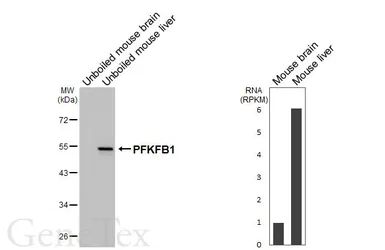 Anti-PFKFB1 antibody [HL6989] used in Western Blot (WB). GTX649851