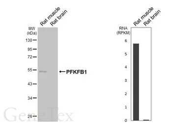 Anti-PFKFB1 antibody [HL6989] used in Western Blot (WB). GTX649851
