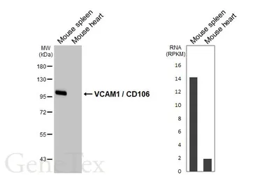 Anti-VCAM1 / CD106 antibody [HL6990] used in Western Blot (WB). GTX649852