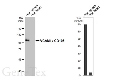Anti-VCAM1 / CD106 antibody [HL6990] used in Western Blot (WB). GTX649852