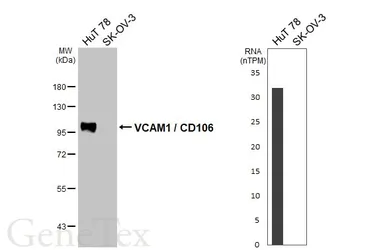 Anti-VCAM1 / CD106 antibody [HL6990] used in Western Blot (WB). GTX649852